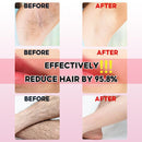 IPL Laser Hair Removal Painles Results in 3 weeks 19J energy Whole Body bikini part Treatment